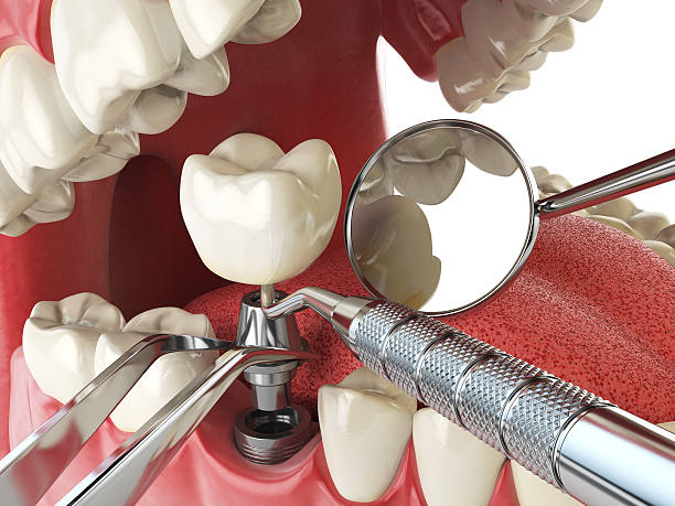 Best Broken or Cracked Tooth Emergency Dentist in Saucier, MS